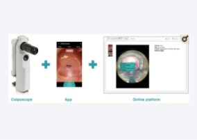 MobileODT: a case study of a novel approach to an mHealth-based model of sustainable impact