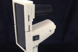 WSJ: Startup Turns Smartphone into Cervical Cancer Detector