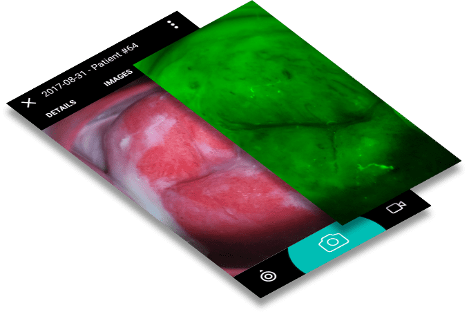 MobileODT Tech Talk: How the colposcope green filter was developed