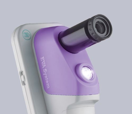 MobileODT launches EVA WELL for general gynecology in the USA