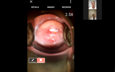 Teleconsultation: Connecting clinicians to benefit patients