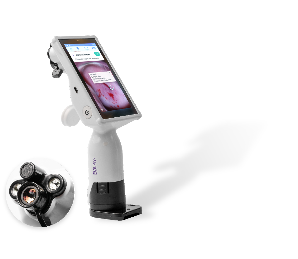 Eva Pro mobile